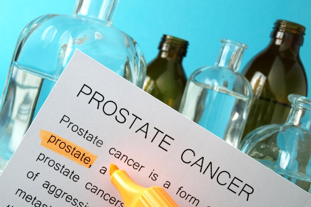 5 Most Common Prostate Cancer Myths