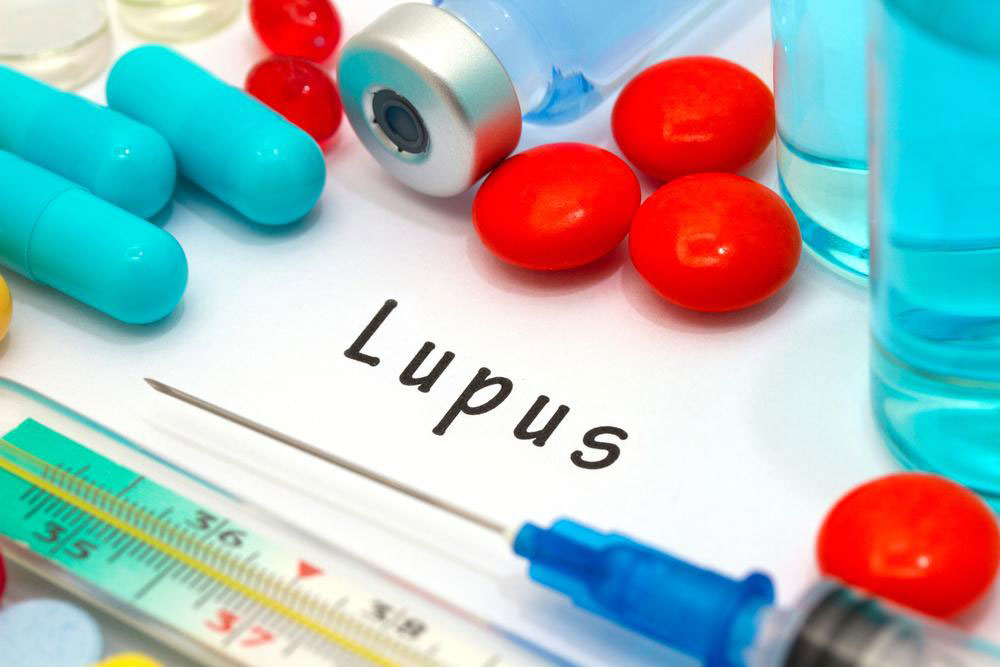 Common Treatment Options For Controlling Lupus