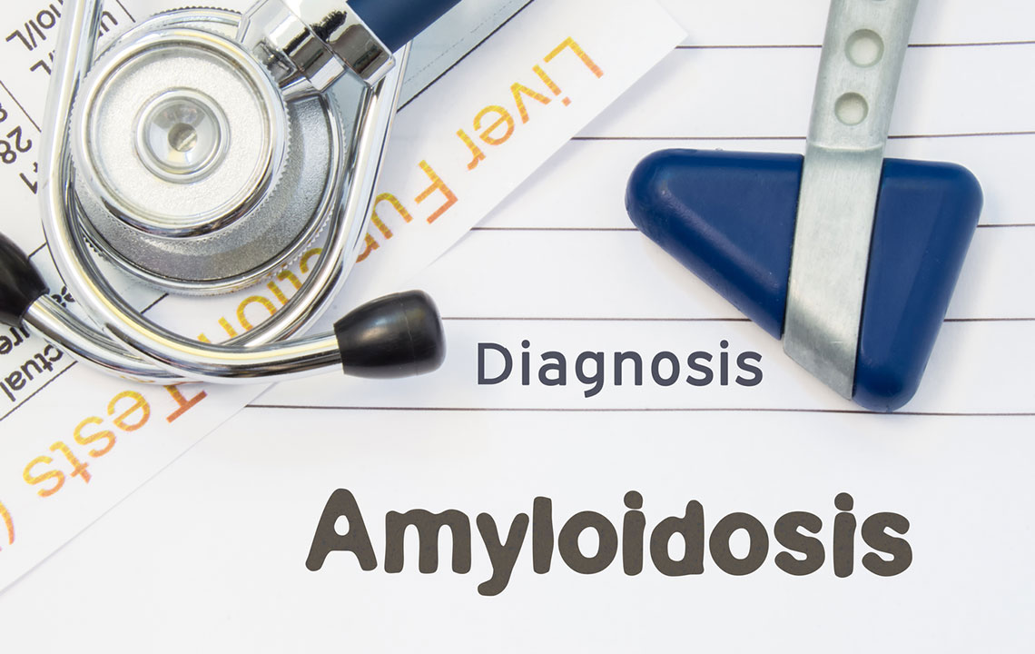 Everything About the Different Types of Amyloidosis