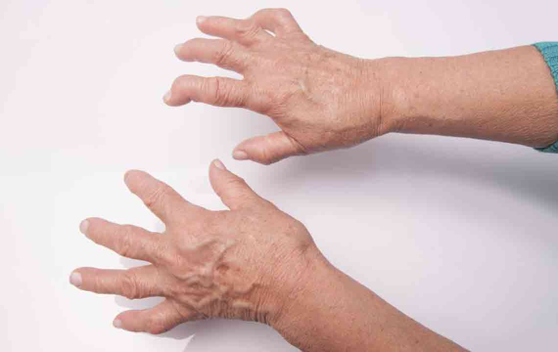 Food Items You Should Avoid When Suffering from Arthritis