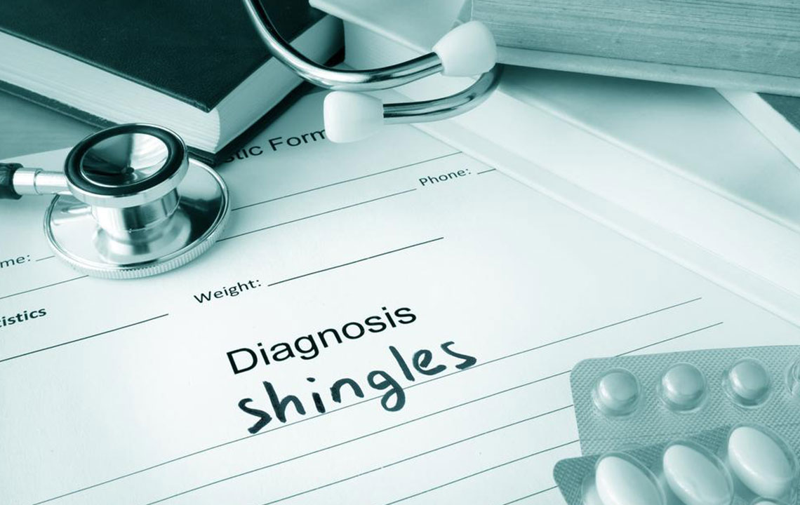 The Best Medication and Natural Treatments for Shingles