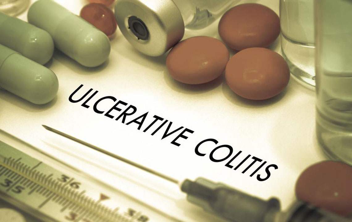 Here Are Some of the Popular Ulcerative Colitis Treatments