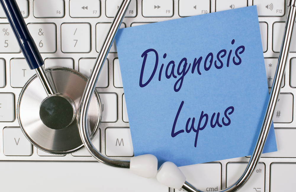 Know about the different ways to diagnose lupus