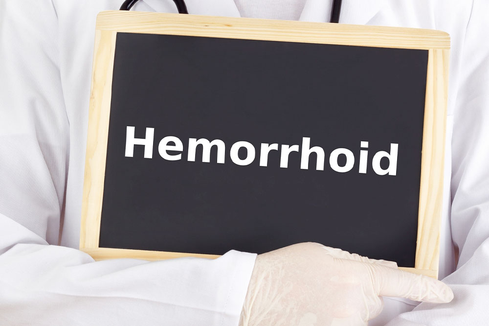 Causes and Treatments of Hemorrhoids